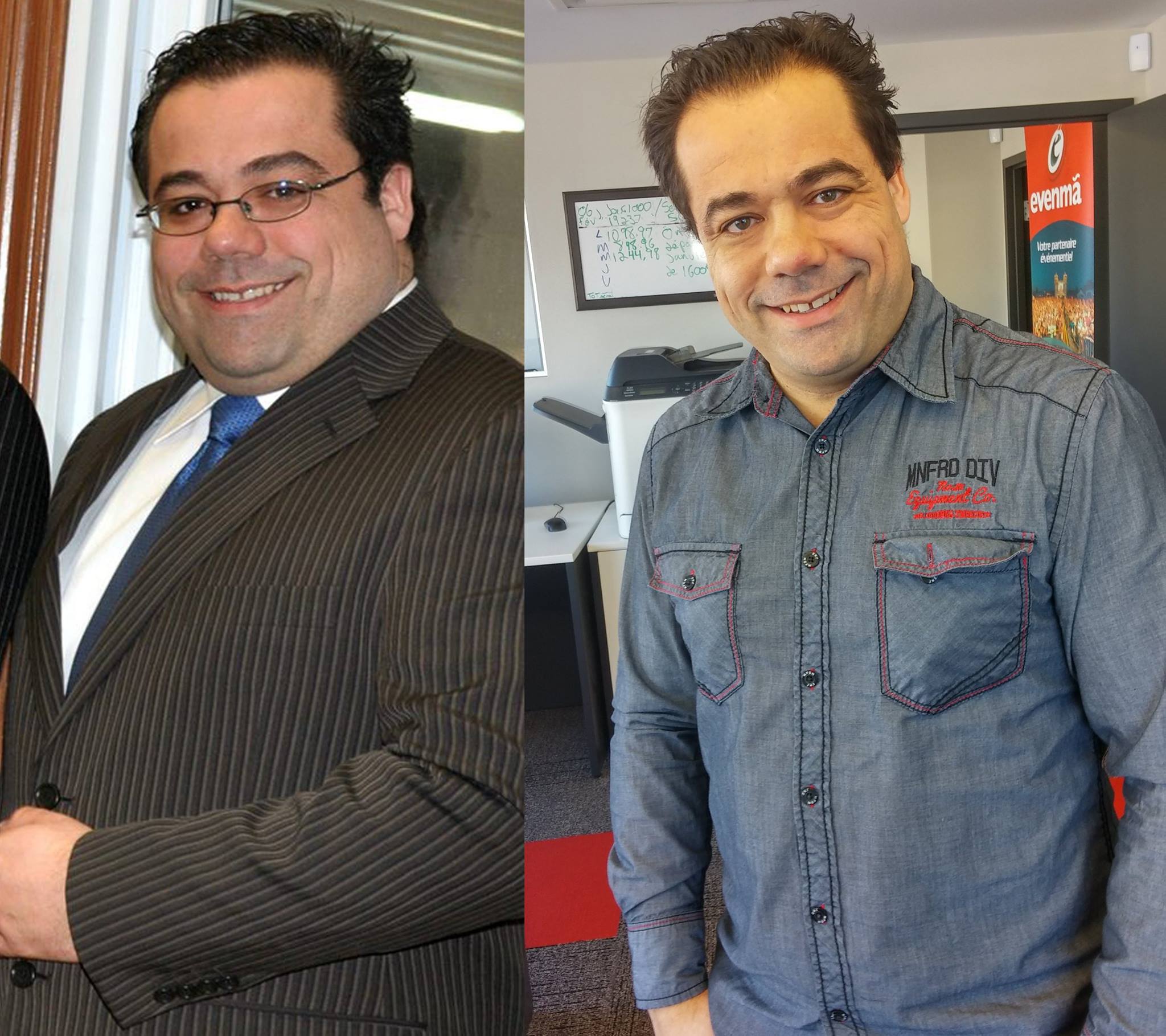 Avant-après récent